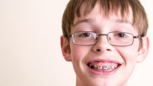 children orthodontics
