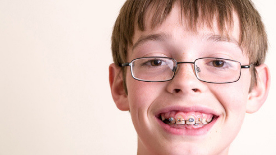 Introducing Early Orthodontics