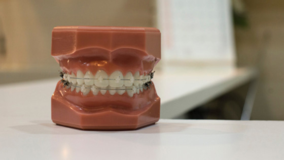 What happens at an Orthodontic Consultation?