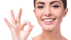 How much do braces cost