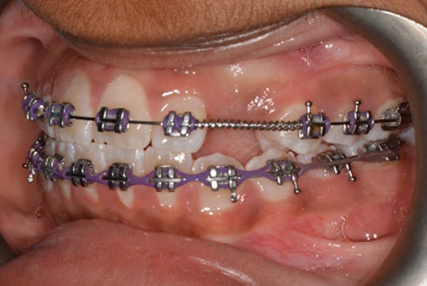 orthodontic, For Dentists