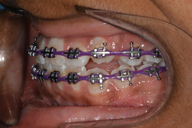 orthodontic, For Dentists