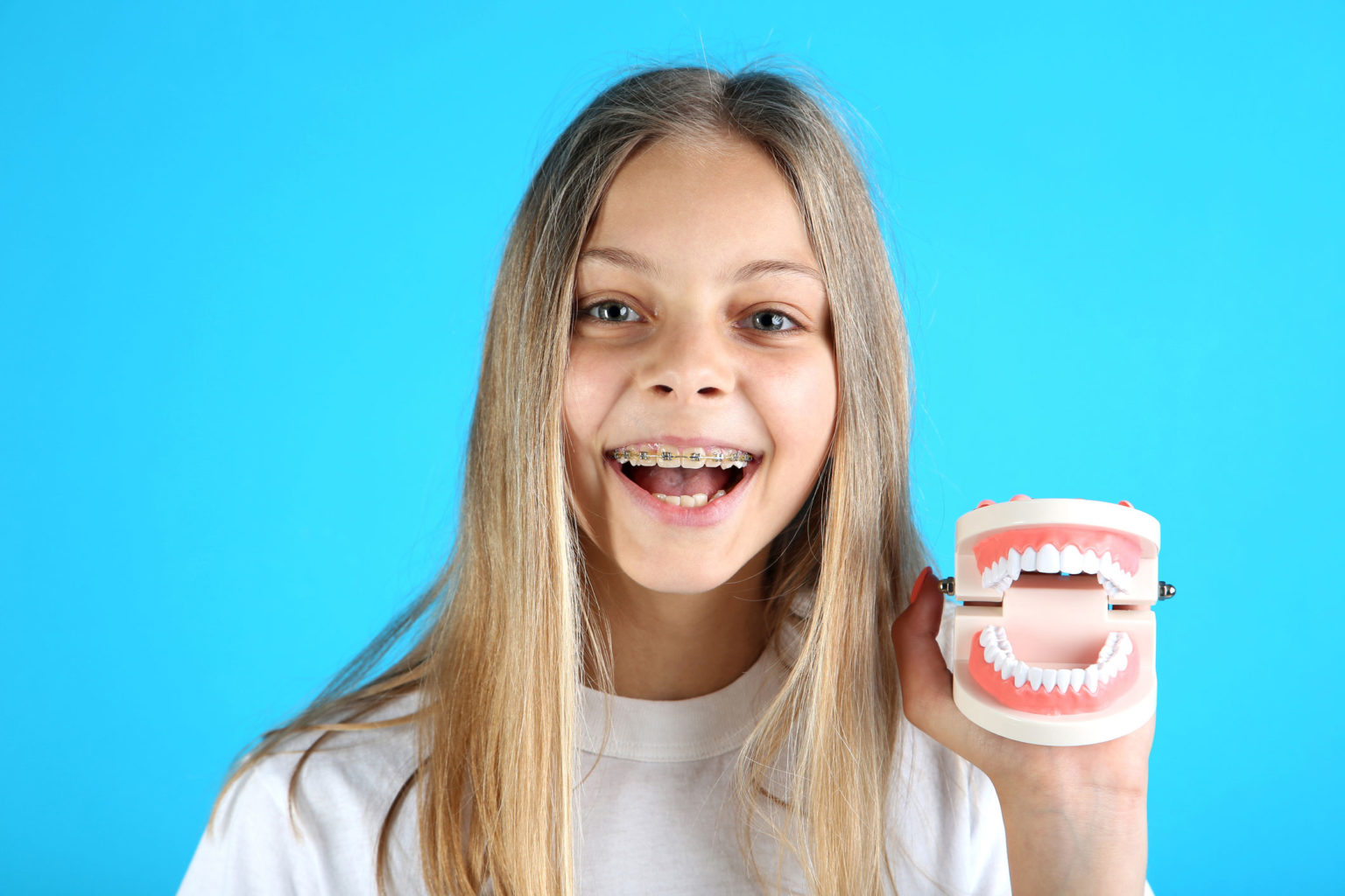 HowDoBracesWork Orthodontic Specialists of Melbourne