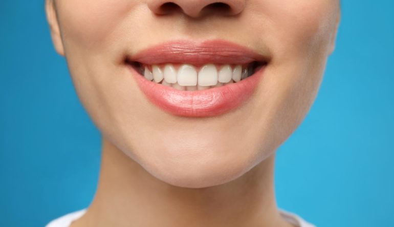 Why It’s Best Not to Try DIY Orthodontics